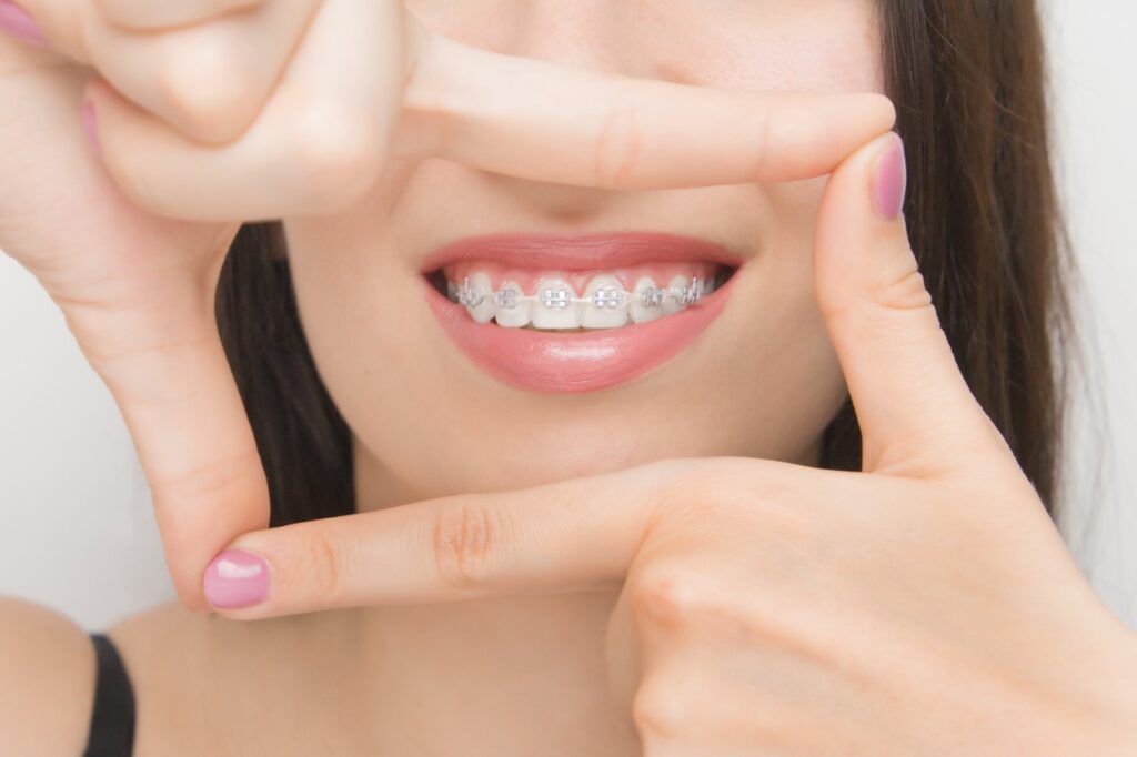 orthodontic img (1)