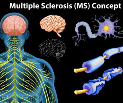 Multiple Sclerosis